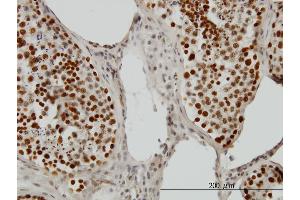 Immunoperoxidase of monoclonal antibody to PSIP1 on formalin-fixed paraffin-embedded human testis.