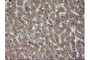 Immunohistochemical staining of paraffin-embedded Human liver tissue using anti-CHN1 mouse monoclonal antibody. (CHN1 Antikörper)