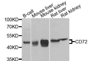 Western blot analysis of extracts of various cell lines, using CD72 antibody. (CD72 Antikörper  (AA 120-359))