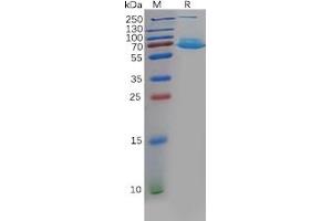 Human CA Protein, hFc Tag on SDS-PAGE under reducing condition.