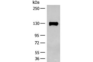 Western blot analysis of Human prostate tissue lysate using SENP6 Polyclonal Antibody at dilution of 1:200