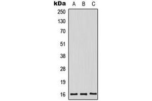 Western blot analysis of Midkine expression in HeLa (A), HepG2 (B), mouse kidney (C) whole cell lysates. (Midkine Antikörper  (Center))