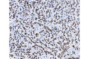 IHC analysis of HnRNP H/HNRNPH1 using anti-HnRNP H/HNRNPH1 antibody (ABIN4886623).