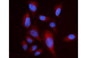 IF analysis of RPL17 using anti-RPL17 antibody (ABIN7601639). (RPL17 Antikörper  (AA 40-167))