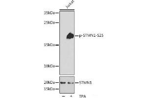 Western blot analysis of extracts of Jurkat cells using Phospho-STMN1(S25) Polyclonal Antibody at dilution of 1:2000. (Stathmin 1 Antikörper  (pSer25))
