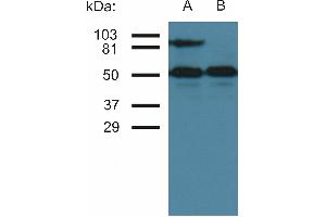 Western blottin analysis of CD54 expression in TNF-alpha activated (A) and nonactivated (B) HUVEC cells by antibody MEM-111.