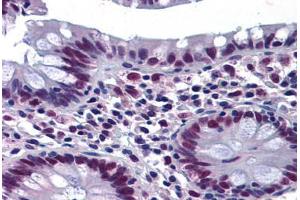 Human Colon: Formalin-Fixed, Paraffin-Embedded (FFPE)