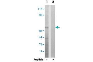 Western blot analysis of extracts from HepG2 cells, using UBXN11 polyclonal antibody . (UBXN11 Antikörper)