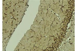 ABIN6276815 at 1/100 staining Mouse brain tissue by IHC-P. (POLB Antikörper  (C-Term))