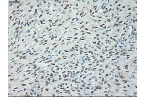 Immunohistochemical staining of paraffin-embedded colon tissue using anti-USP13mouse monoclonal antibody. (USP13 Antikörper)