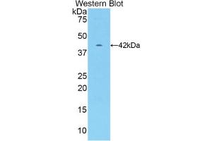 Western blot analysis of the recombinant protein. (CKM Antikörper  (AA 11-367))