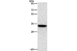 Western blot analysis of PC3 cell, using HOXB13 Polyclonal Antibody at dilution of 1:800 (HOXB13 Antikörper)