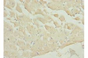 Immunohistochemistry of paraffin-embedded human heart tissue using ABIN7163185 at dilution of 1:100