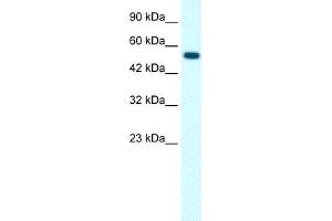 WB Suggested Anti-GLRA1 Antibody Titration:  0. (GLRA1 Antikörper  (Middle Region))