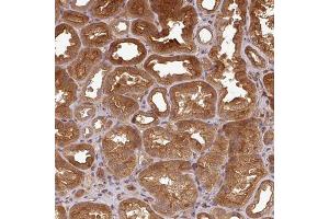 Immunohistochemical staining (Formalin-fixed paraffin-embedded sections) of human kidney with ART1 polyclonal antibody  shows strong cytoplasmic and membranous positivity in cells in tubules.