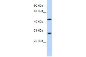 Western Blotting (WB) image for anti-Pygopus Homolog 2 (PYGO2) antibody (ABIN2459475) (PYGO2 Antikörper)