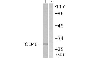 Immunohistochemistry analysis of paraffin-embedded human breast carcinoma tissue using CD40 antibody. (CD40 Antikörper  (C-Term))