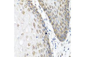 Immunohistochemistry of paraffin-embedded human esophagus using ANGPT1 antibody at dilution of 1:100 (40x lens).