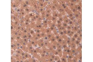 Used in DAB staining on fromalin fixed paraffin- embedded Kidney tissue (PIDD Antikörper  (AA 668-917))