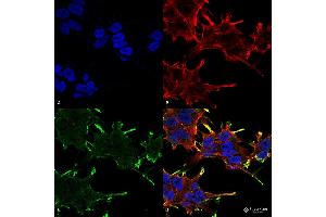 Immunocytochemistry/Immunofluorescence analysis using Mouse Anti-Alpha B Crystallin Monoclonal Antibody, Clone 1A7. (CRYAB Antikörper  (PE))
