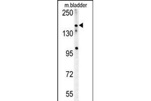 CASZ1 Antibody (C-term) (ABIN654196 and ABIN2844046) western blot analysis in mouse bladder tissue lysates (15 μg/lane). (CASZ1 Antikörper  (C-Term))