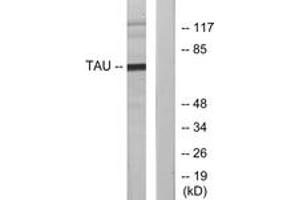 Western blot analysis of extracts from MDA-MB-435 cells, using Tau (Ab-231) Antibody. (tau Antikörper  (AA 521-570))
