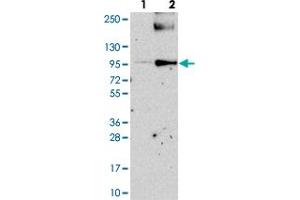 Western blot analysis of Lane 1: Negative control (vector only transfected HEK293T lysate). (PIGN Antikörper)
