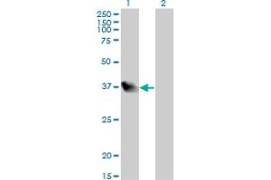 Western Blotting (WB) image for anti-Leucine Zipper Transcription Factor-Like 1 (LZTFL1) (AA 200-299) antibody (ABIN565756)