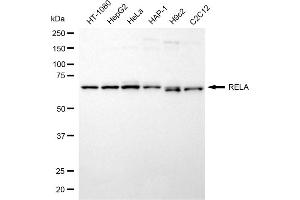 Western blotting analysis using RELA antibody (ABIN7799647). (NF-kB p65 Antikörper)