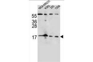 FGF22 Antibody (N-term) western blot analysis in MDA-MB231,K562,293,CEM cell line lysates (35µg/lane).