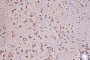 Immunohistochemistry of paraffin-embedded mouse spinal cord using RanG Rabbit mAb (ABIN7269846) at dilution of 1:100 (40x lens). (RANGAP1 Antikörper)