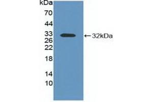Western blot analysis of recombinant Mouse ITGaV.