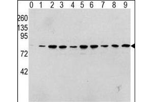 Western blot analysis of Phospho-RAF1-p Antibody in human T activated Hela cell line lysates. (RAF1 Antikörper  (pSer338))