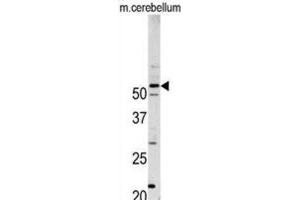 Western Blotting (WB) image for anti-Cyclin-Dependent Kinase 14 (CDK14) antibody (ABIN3003282) (CDK14 Antikörper)