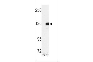 Western blot analysis of RENT1 using rabbit polyclonal RENT1 Antibody using 293 cell lysates (2 ug/lane) either nontransfected (Lane 1) or transiently transfected with the RENT1 gene (Lane 2). (RENT1/UPF1 Antikörper  (N-Term))