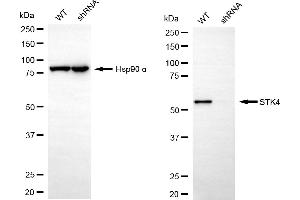 Western blotting analysis using STK4 antibody (ABIN7800314).