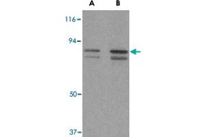 Western blot analysis of ATF6 in MCF-7 cell lysate with ATF6 polyclonal antibody  at (A) 0.