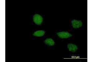 Immunofluorescence of purified MaxPab antibody to TWIST1 on HeLa cell. (TWIST1 Antikörper  (AA 1-202))