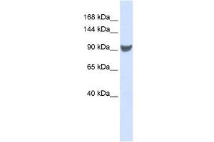 XPO1 antibody used at 1 ug/ml to detect target protein. (XPO1 Antikörper)