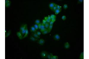 Immunofluorescence staining of HepG2 cells with ABIN7144643 at 1:133, counter-stained with DAPI. (AS3MT Antikörper  (AA 262-375))