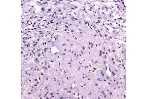 Immunohistochemistry (IHC) image for anti-Runt-Related Transcription Factor 1, Translocated To, 1 (Cyclin D-Related) (RUNX1T1) (AA 335-510) antibody (ABIN5693284)