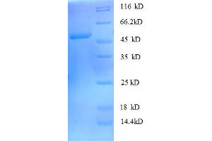 SDS-PAGE (SDS) image for rho GDP Dissociation Inhibitor (GDI) alpha (ARHGDIA) (AA 2-204) protein (GST tag) (ABIN5712033) (ARHGDIA Protein (AA 2-204) (GST tag))