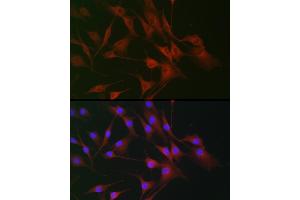 Immunofluorescence (IF) image for anti-Interleukin 6 Signal Transducer (Gp130, Oncostatin M Receptor) (IL6ST) (AA 678-857) antibody (ABIN7268003)