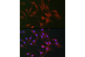 Immunofluorescence analysis of NIH/3T3 cells using IL6ST antibody (ABIN7268003) at dilution of 1:100. (CD130/gp130 Antikörper  (AA 678-857))