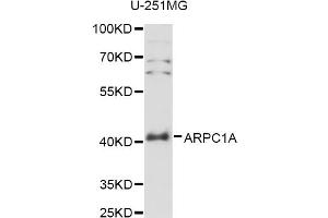 Western blot analysis of extracts of U-251MG cells, using ARPC1A antibody (ABIN6291261) at 1:3000 dilution. (ARPC1A Antikörper)