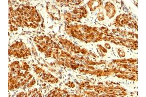 Formalin-fixed, paraffin-embedded human Uterus stained with Calponin-1 Mouse Monoclonal Antibody (CNN1/832). (CNN1 Antikörper)