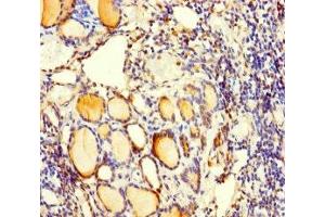 Immunohistochemistry of paraffin-embedded human thyroid tissue using ABIN7175061 at dilution of 1:100 (C5orf51 Antikörper  (AA 8-152))