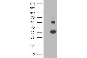 Western Blotting (WB) image for anti-Monoglyceride Lipase (MGLL) antibody (ABIN1499438) (MGLL Antikörper)