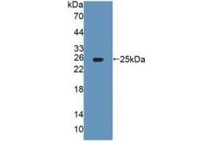 Detection of Recombinant AGXT, Rat using Polyclonal Antibody to Alanine Glyoxylate Aminotransferase (AGXT) (AGXT Antikörper  (AA 182-371))