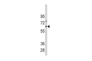 Western blot analysis of anti-CYP1B1 Antibody (Center) (ABIN392376 and ABIN2842009) in CEM cell line lysates (35 μg/lane).